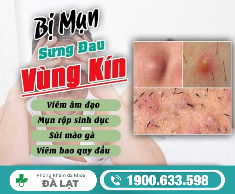 Hình ảnh minh họa